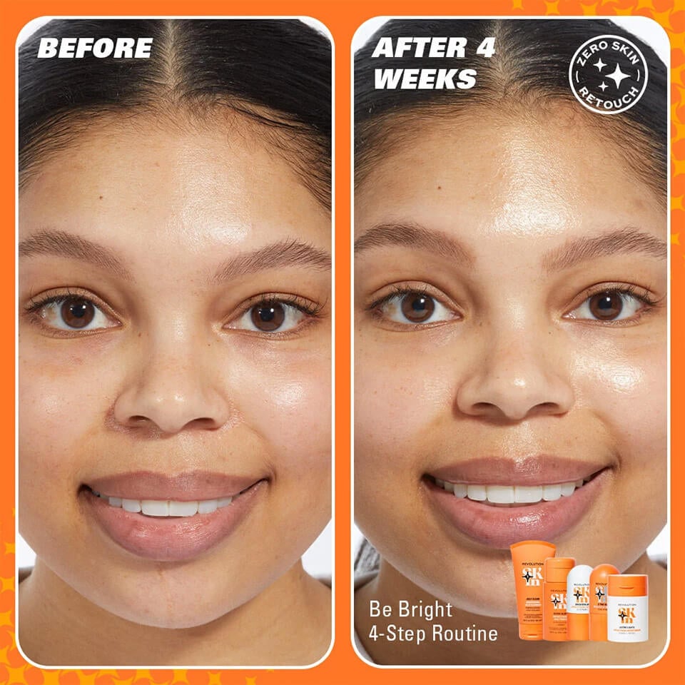 Before and after image of a model who tested the Be Bright Routine for 4 weeks